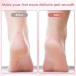 Rechargable Flawless Pedicure Tool For Foot Cleaning - Image 5